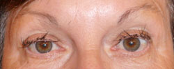 eyebrows