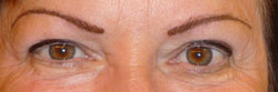 eyebrows