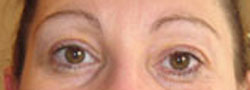 eyebrows