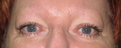 eyebrows