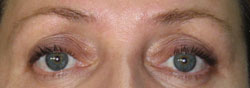 eyebrows