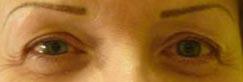 eyebrows