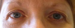 eyebrow