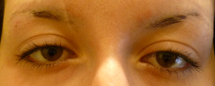 eyebrow