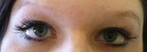 eyebrow