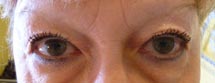 eyebrow