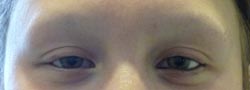 eyebrow
